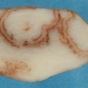 An example of a potato with mop-top virus